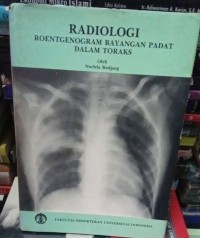 Radiologi Roentgenogram Bayangan Padat Dalam Toraks
